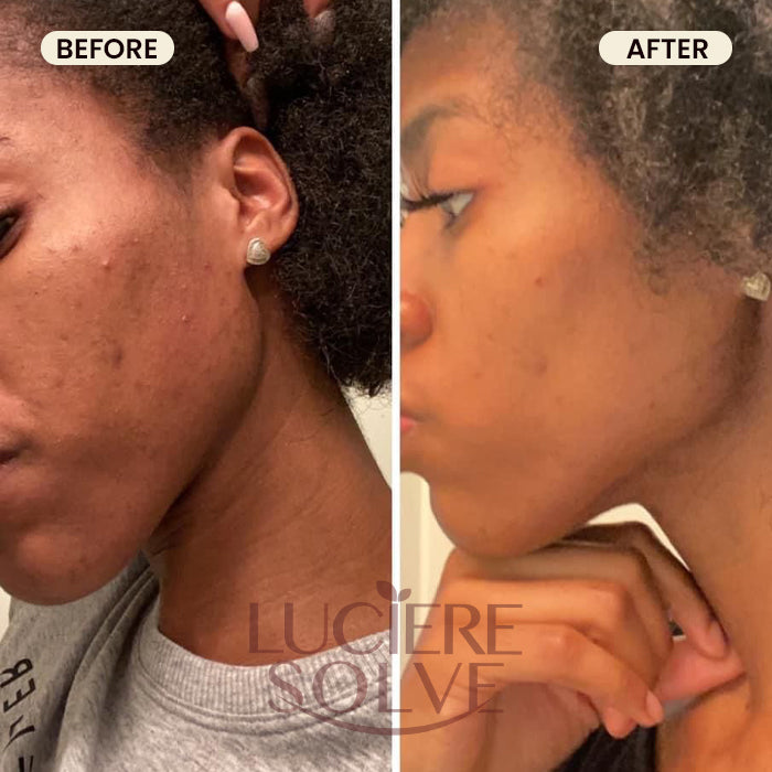 Luciere Solve Turmeric Glow Bundle – Face & Body Kit