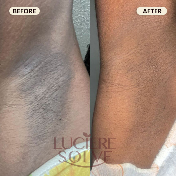 Luciere Solve Turmeric Glow Bundle – Face & Body Kit