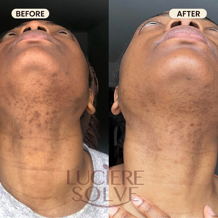 Luciere Solve Turmeric Glow Bundle – Face & Body Kit