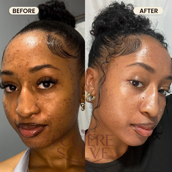 Turmeric Soap - Face & Body Cleanser