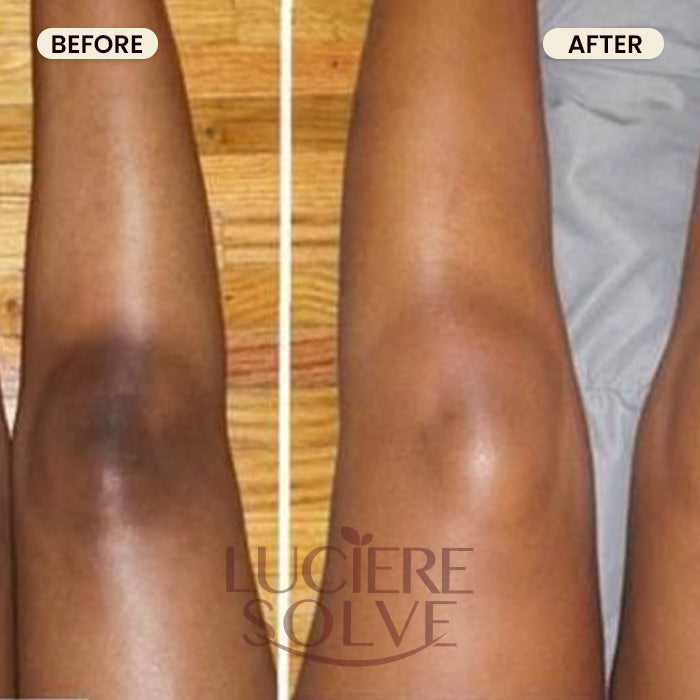 Luciere Solve Turmeric Glow Bundle – Face & Body Kit